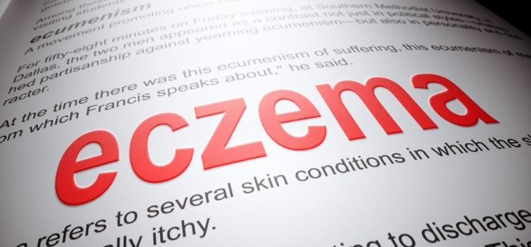 eczema in homeopathic