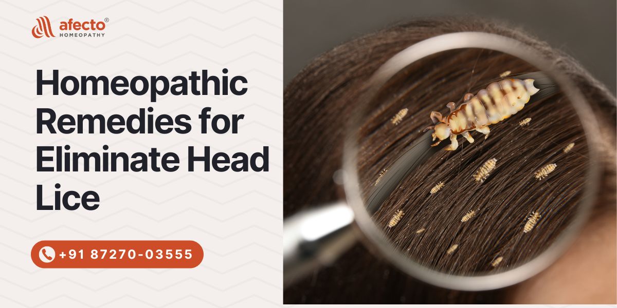 Homeopathic Remedies for Eliminate Head Lice