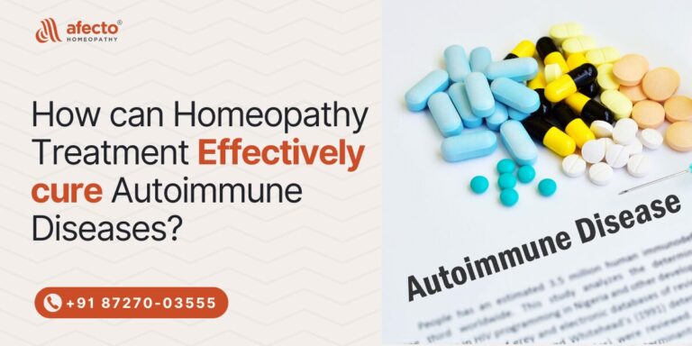 How can Homeopathy Treatment Effectively cure Autoimmune Diseases