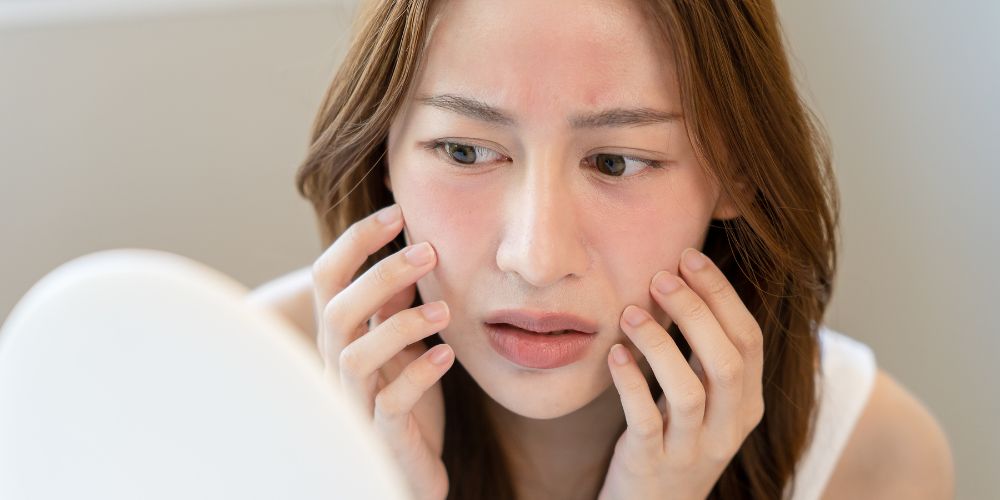 Types of Allergies on skin