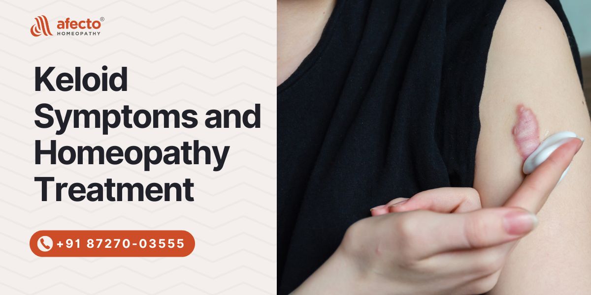Keloid Symptoms and Homeopathy Treatment