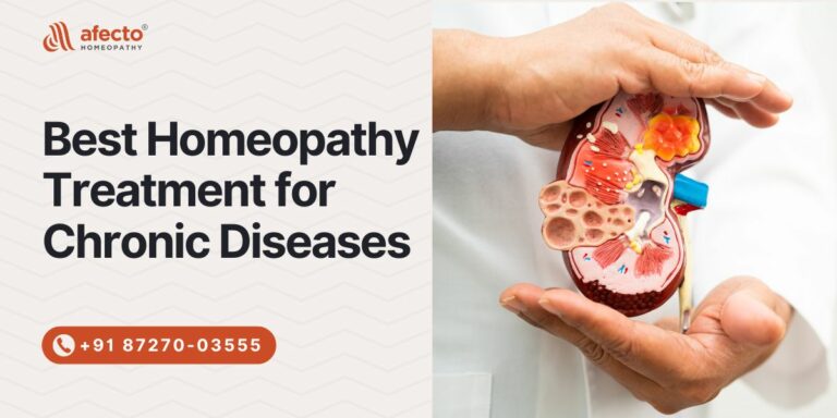 homeopathy treatment for chronic diseases
