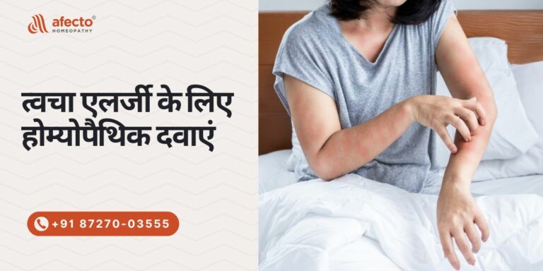 त्वचा एलर्जी के लिए होम्योपैथिक दवाएं