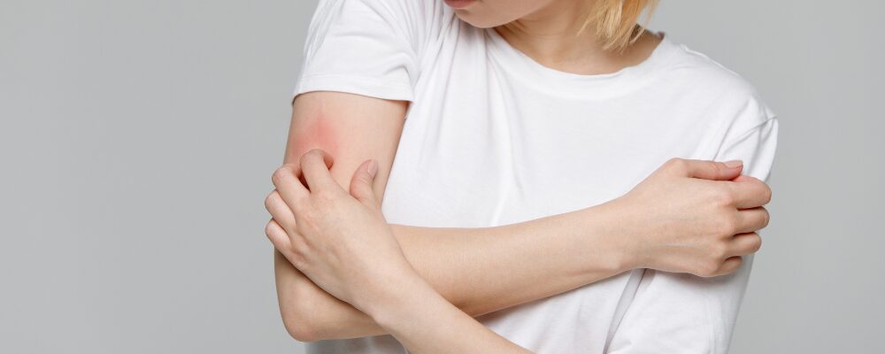 common winter skin allergies