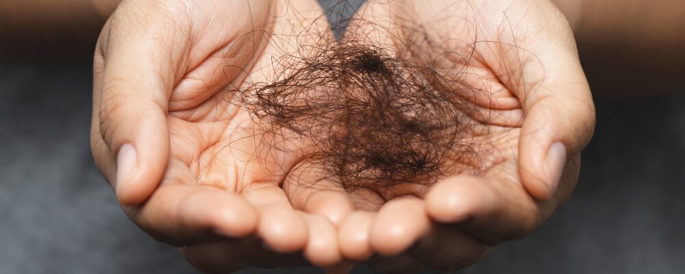 hair loss home remedies