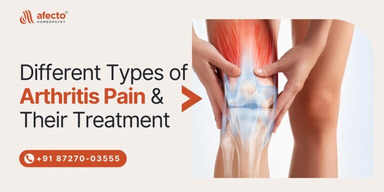 Different Types of Arthritis Pain & Their Treatment