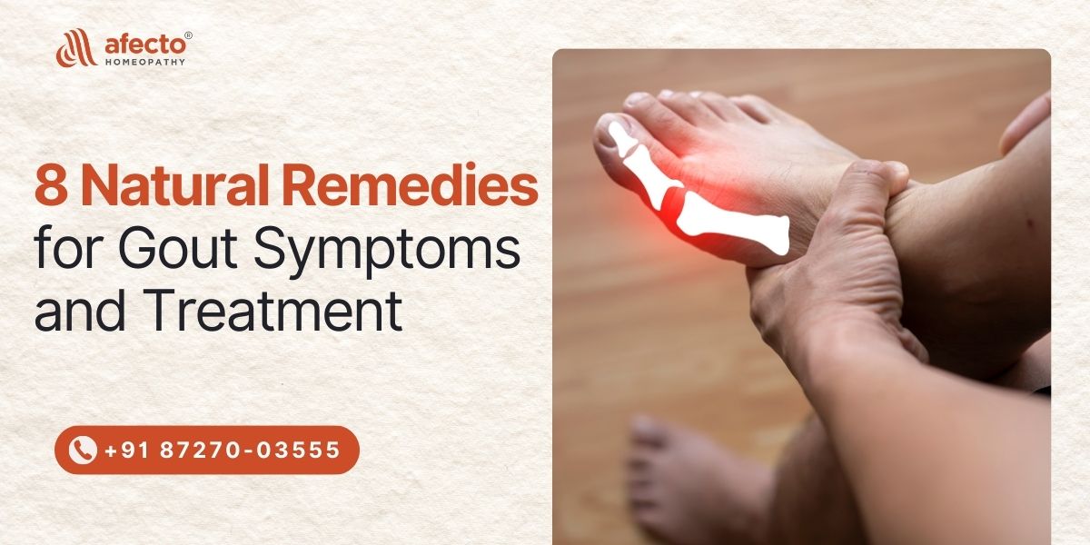 8 Natural Remedies for Gout Symptoms and Treatment