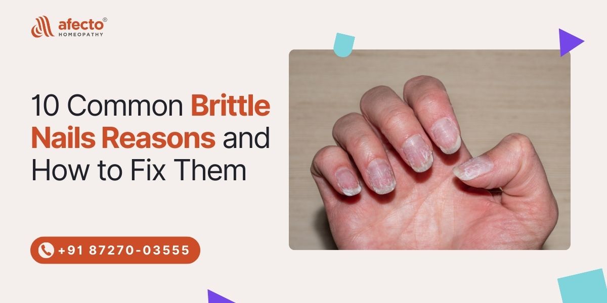 10 Common Brittle Nails Reasons and How to Fix Them