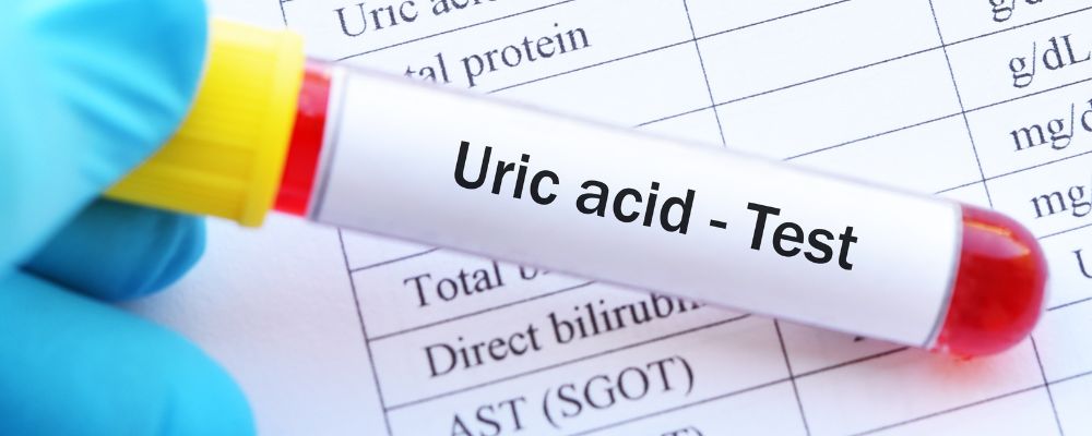 side effects of uric acid