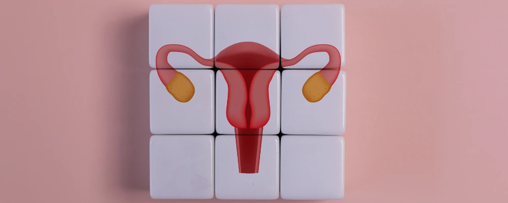 Why PCOS Is More Than Just Weight Gain