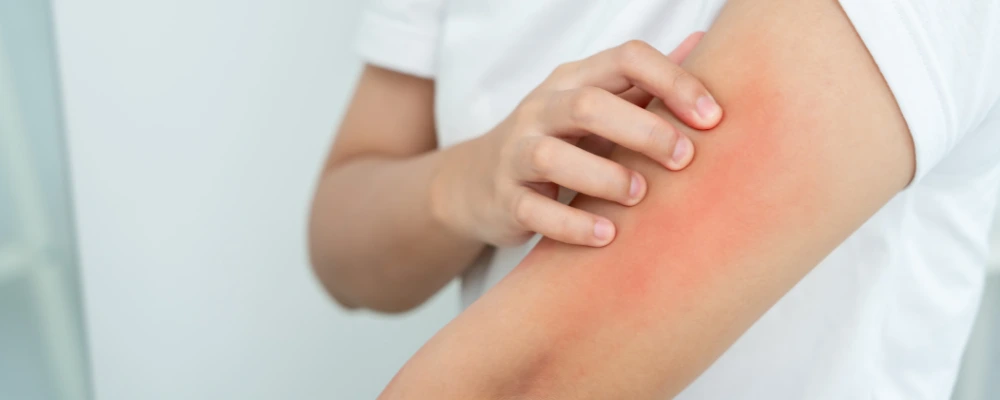 Heat Makes Your Skin Grumpy