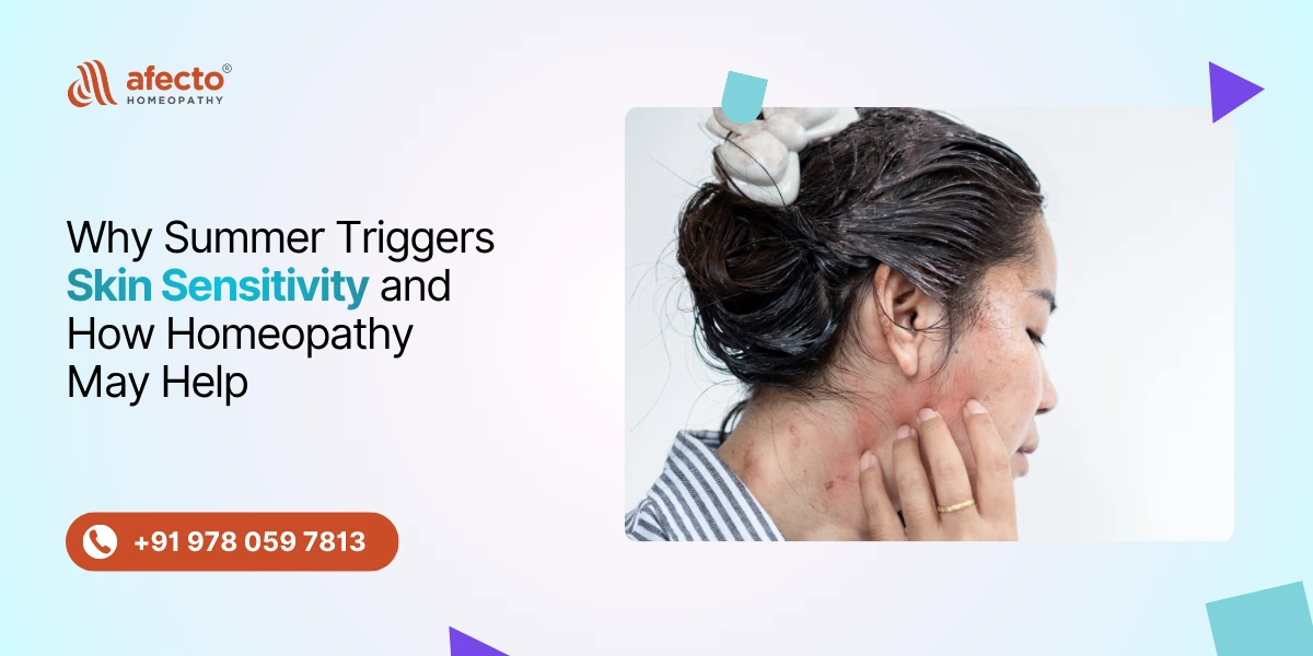 Why Summer Triggers Skin Sensitivity and How Homeopathy May Help