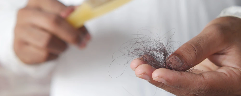 why hair fall increase