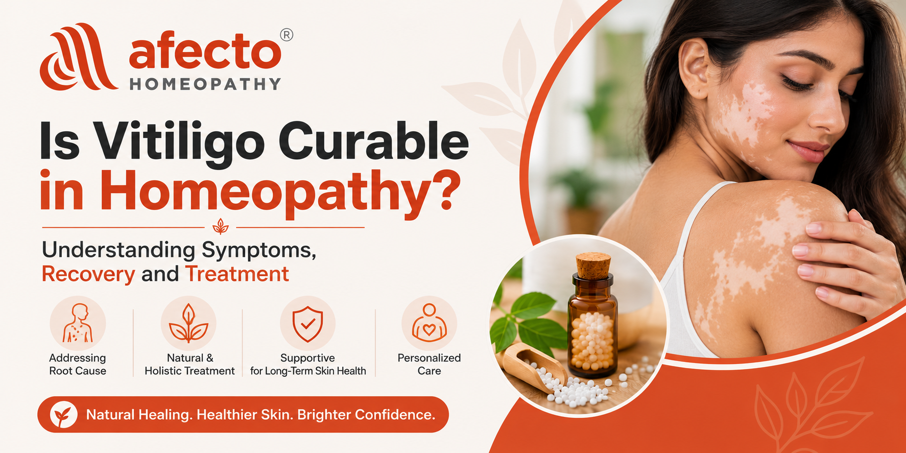 Is Vitiligo Curable in Homeopathy